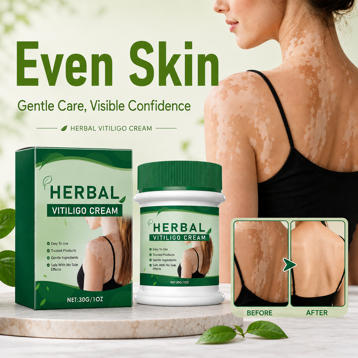 Herbal Vitiligo Skin Care Cream – Botanical Moisturizing & Skin Conditioning Formula✨