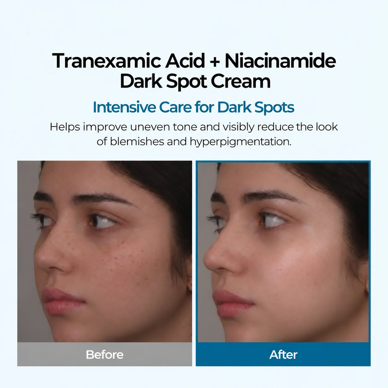 Before and after appearance comparison for uneven skin tone