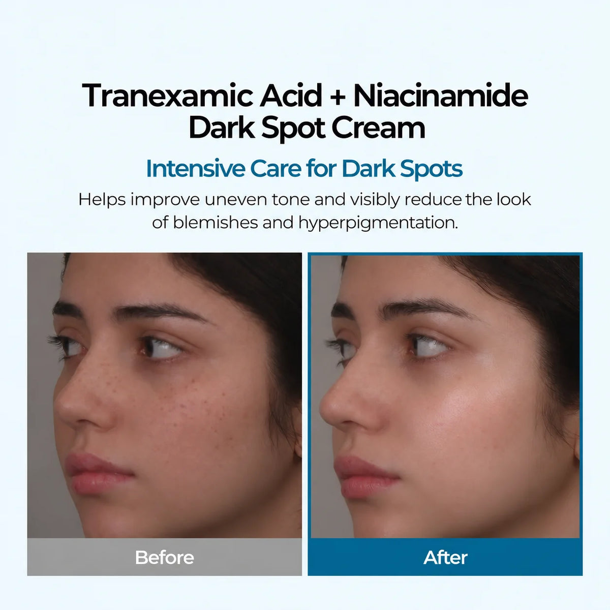 Tranexamic Acid + Niacinamide Dark Spot Cream