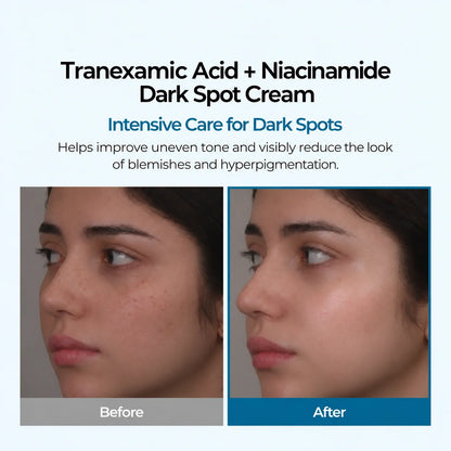 Tranexamic Acid + Niacinamide Dark Spot Cream