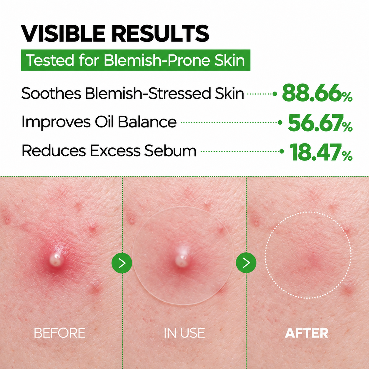 Blemish Care before, in-use and after result comparison
