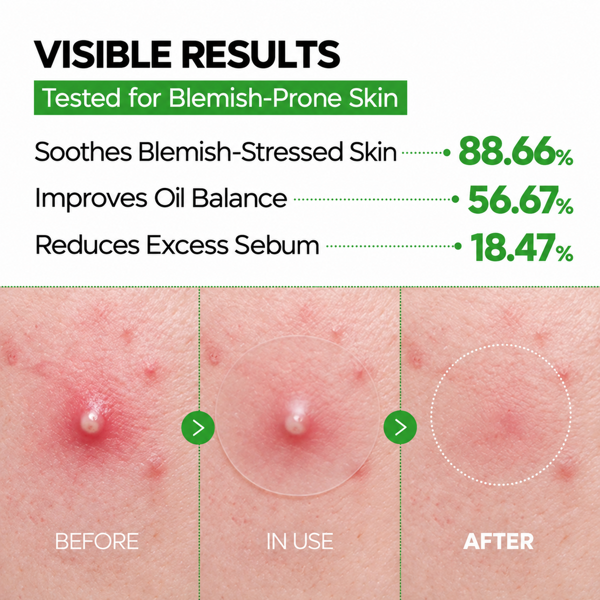 2-Step Blemish & Dark Spot Care Patch Duo