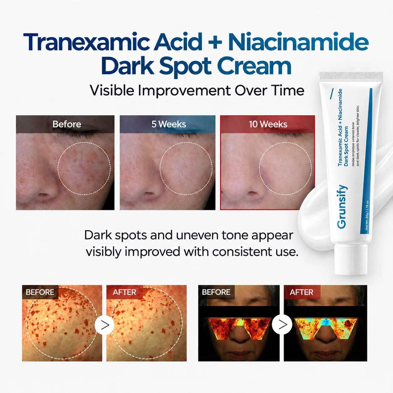 Appearance of dark spots over a consistent skincare routine