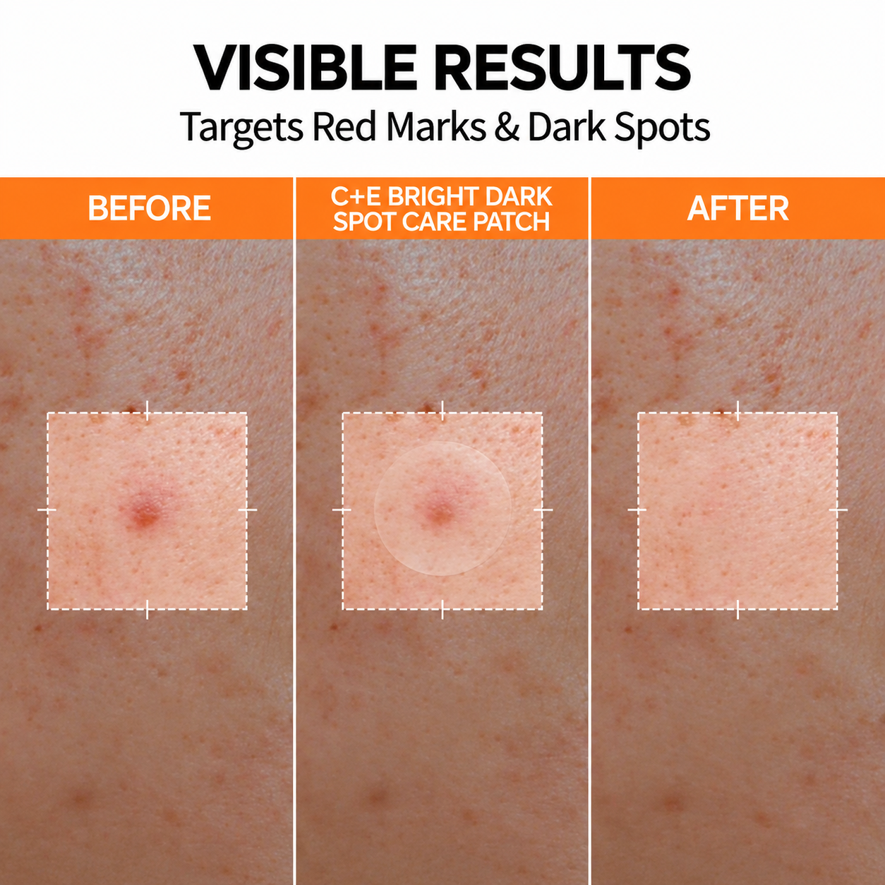 C+E Bright before, patch and after comparison for post-blemish marks