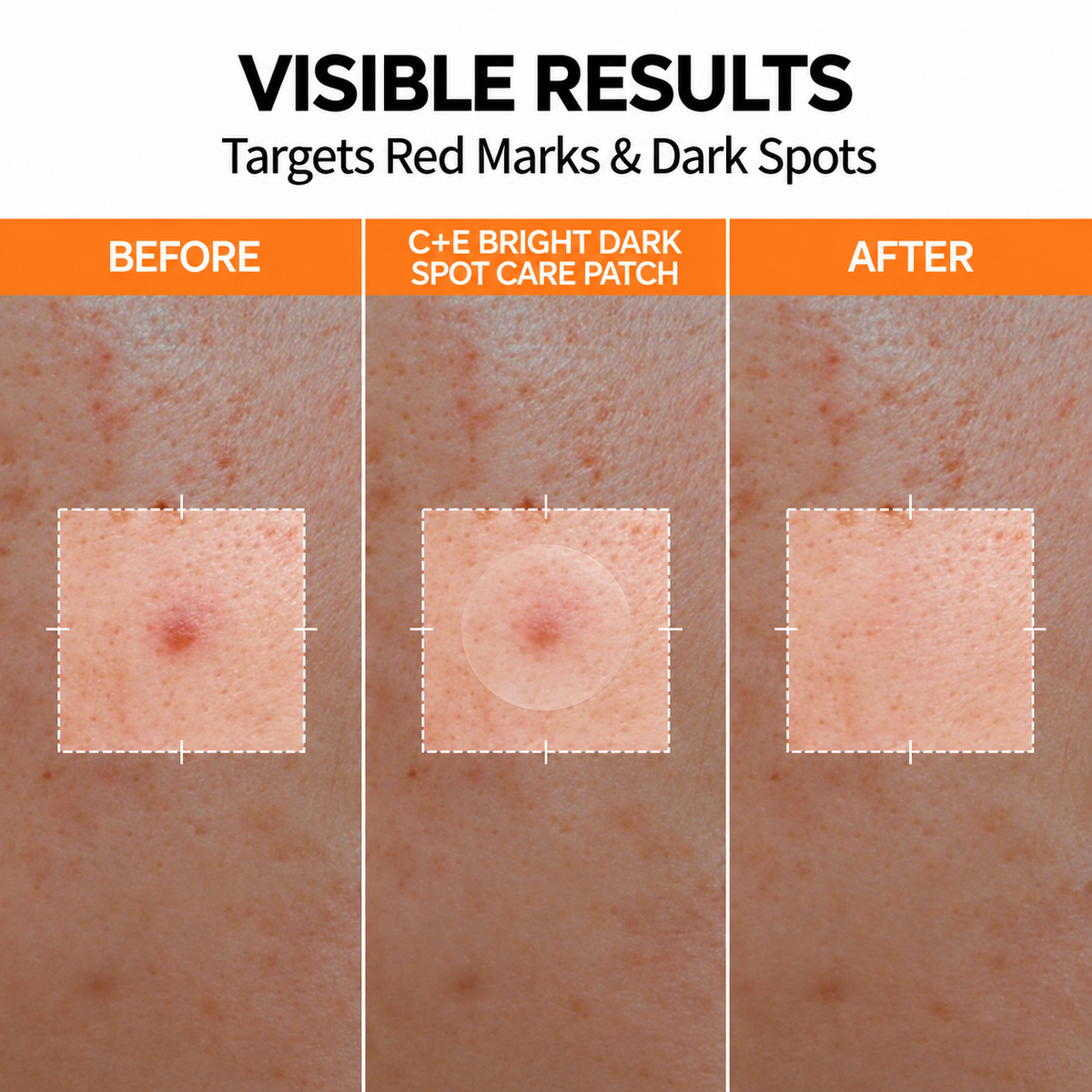 2-Step Blemish & Dark Spot Care Patch Duo