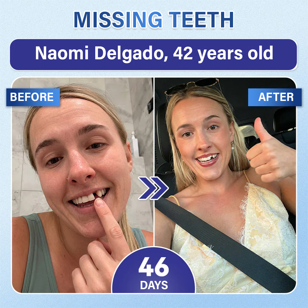 Tooth & Gum Care Fast-Dissolving Microneedle Patch✨ (𝟓-𝐢𝐧-𝟏 💎 𝐑𝐞𝐛𝐮𝐢𝐥𝐝 𝐄𝐧𝐚𝐦𝐞𝐥 & 𝐃𝐞𝐧𝐭𝐢𝐧 • 𝐒𝐭𝐫𝐞𝐧𝐠𝐭𝐡𝐞𝐧 𝐆𝐮𝐦𝐬 • 𝐄𝐫𝐚𝐝𝐢𝐜𝐚𝐭𝐞 𝐓𝐚𝐫𝐭𝐚𝐫 & 𝐎𝐝𝐨𝐫 • 𝐖𝐡𝐢𝐭𝐞𝐧𝐢𝐧𝐠 • 𝐒𝐭𝐨𝐩 𝐓𝐨𝐨𝐭𝐡 𝐒𝐞𝐧𝐬𝐢𝐭𝐢𝐯𝐢𝐭𝐲)