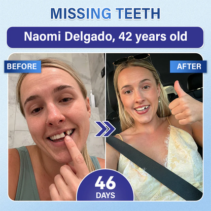 Tooth & Gum Care Fast-Dissolving Microneedle Patch✨ (𝟓-𝐢𝐧-𝟏 💎 𝐑𝐞𝐛𝐮𝐢𝐥𝐝 𝐄𝐧𝐚𝐦𝐞𝐥 & 𝐃𝐞𝐧𝐭𝐢𝐧 • 𝐒𝐭𝐫𝐞𝐧𝐠𝐭𝐡𝐞𝐧 𝐆𝐮𝐦𝐬 • 𝐄𝐫𝐚𝐝𝐢𝐜𝐚𝐭𝐞 𝐓𝐚𝐫𝐭𝐚𝐫 & 𝐎𝐝𝐨𝐫 • 𝐖𝐡𝐢𝐭𝐞𝐧𝐢𝐧𝐠 • 𝐒𝐭𝐨𝐩 𝐓𝐨𝐨𝐭𝐡 𝐒𝐞𝐧𝐬𝐢𝐭𝐢𝐯𝐢𝐭𝐲)