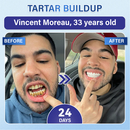 Tooth & Gum Care Fast-Dissolving Microneedle Patch✨ (𝟓-𝐢𝐧-𝟏 💎 𝐑𝐞𝐛𝐮𝐢𝐥𝐝 𝐄𝐧𝐚𝐦𝐞𝐥 & 𝐃𝐞𝐧𝐭𝐢𝐧 • 𝐒𝐭𝐫𝐞𝐧𝐠𝐭𝐡𝐞𝐧 𝐆𝐮𝐦𝐬 • 𝐄𝐫𝐚𝐝𝐢𝐜𝐚𝐭𝐞 𝐓𝐚𝐫𝐭𝐚𝐫 & 𝐎𝐝𝐨𝐫 • 𝐖𝐡𝐢𝐭𝐞𝐧𝐢𝐧𝐠 • 𝐒𝐭𝐨𝐩 𝐓𝐨𝐨𝐭𝐡 𝐒𝐞𝐧𝐬𝐢𝐭𝐢𝐯𝐢𝐭𝐲)