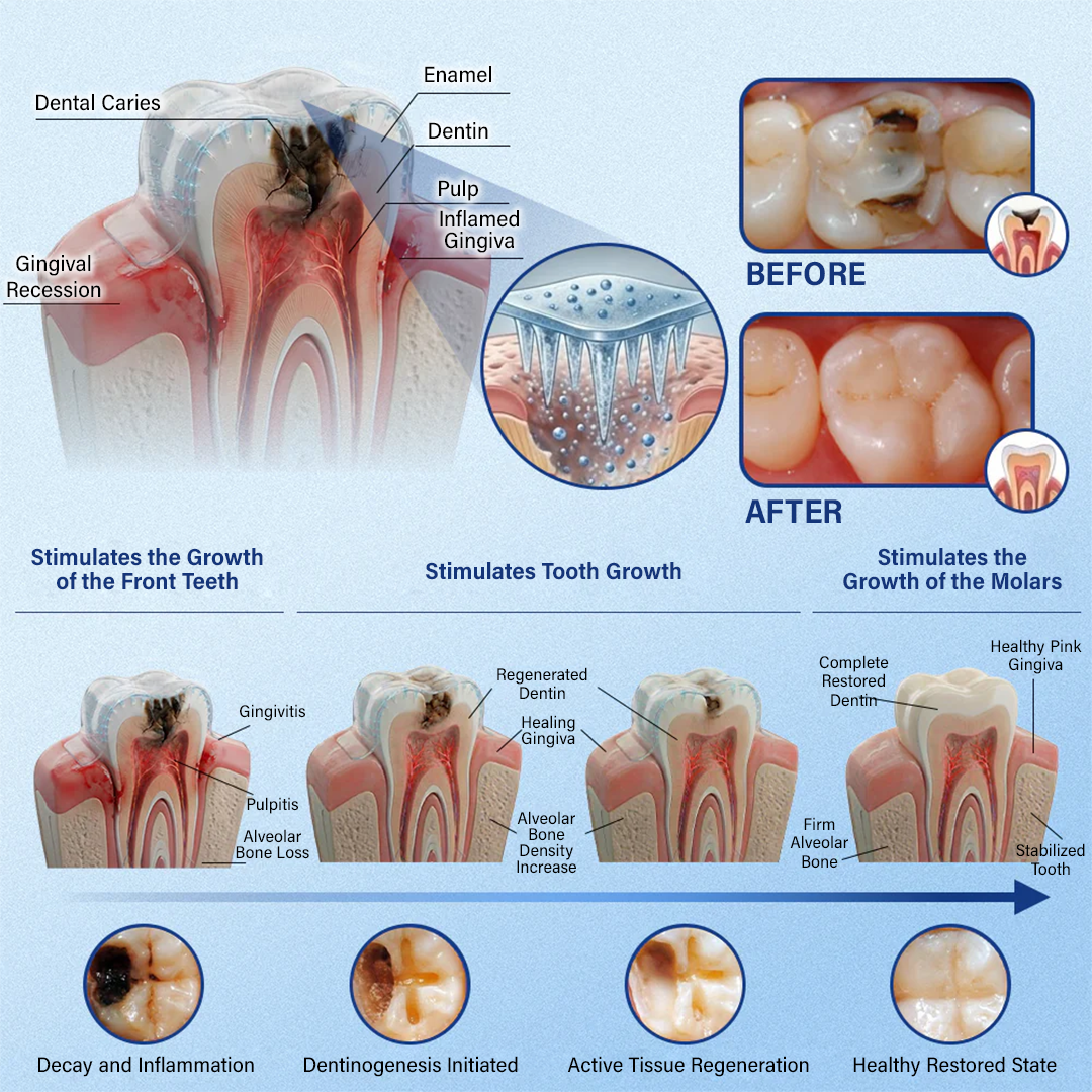 Tooth & Gum Care Fast-Dissolving Microneedle Patch✨ (𝟓-𝐢𝐧-𝟏 💎 𝐑𝐞𝐛𝐮𝐢𝐥𝐝 𝐄𝐧𝐚𝐦𝐞𝐥 & 𝐃𝐞𝐧𝐭𝐢𝐧 • 𝐒𝐭𝐫𝐞𝐧𝐠𝐭𝐡𝐞𝐧 𝐆𝐮𝐦𝐬 • 𝐄𝐫𝐚𝐝𝐢𝐜𝐚𝐭𝐞 𝐓𝐚𝐫𝐭𝐚𝐫 & 𝐎𝐝𝐨𝐫 • 𝐖𝐡𝐢𝐭𝐞𝐧𝐢𝐧𝐠 • 𝐒𝐭𝐨𝐩 𝐓𝐨𝐨𝐭𝐡 𝐒𝐞𝐧𝐬𝐢𝐭𝐢𝐯𝐢𝐭𝐲)