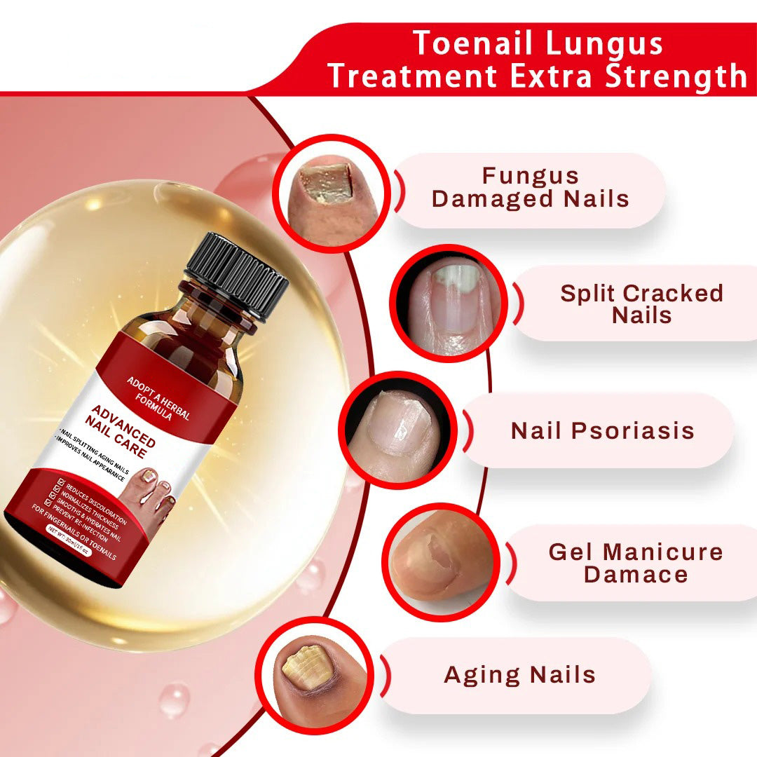 Advanced Nail Care Solution For Fingernails & Toenails – Nail Repair Treatment