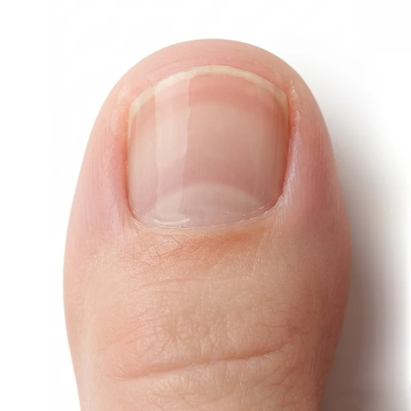 Healthy-looking nail result