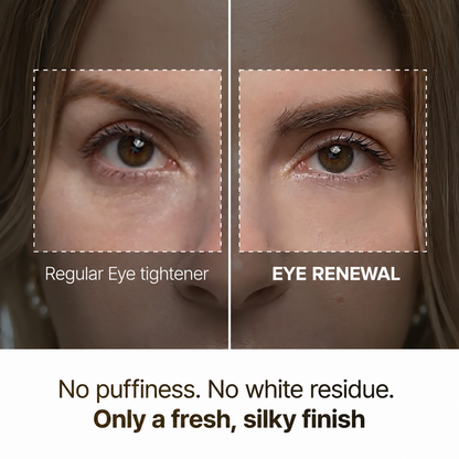 EYE RENEWAL Retinol + Caffeine Eye Cream – Smoother-Looking Under-Eyes & Transparent Finish