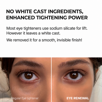 EYE RENEWAL Retinol + Caffeine Eye Cream – Smoother-Looking Under-Eyes & Transparent Finish