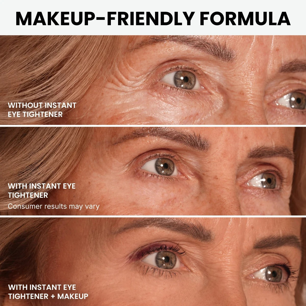 Eye area shown without treatment, with treatment, and with treatment plus makeup
