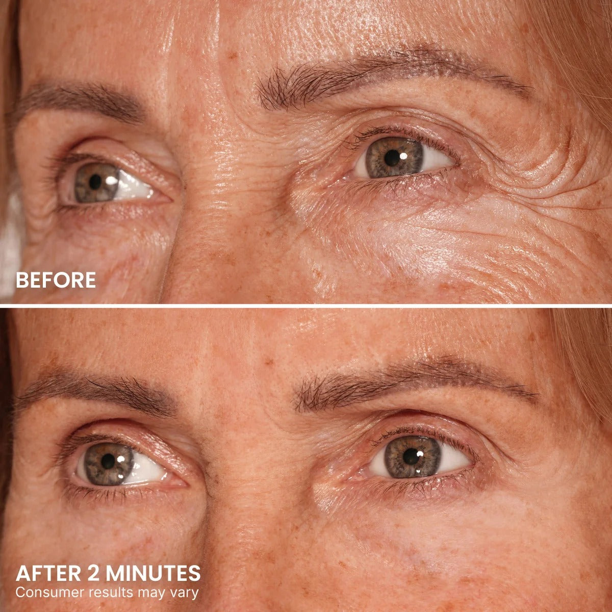 Before and after eye-area example showing the appearance of crow's feet