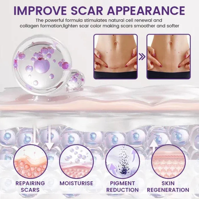 Product artwork illustrating moisturising, smoother-looking skin and improved scar appearance