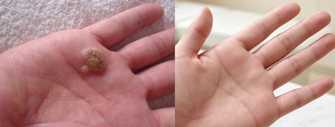 Before-and-after appearance example on the palm